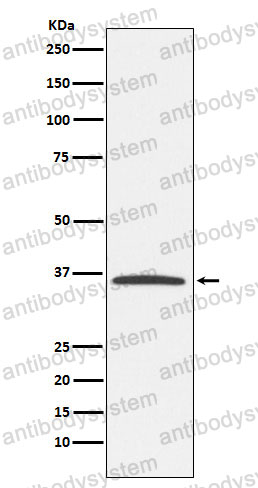 Anti-E2F6 Antibody (R1F38)