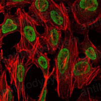 Anti-PSIP1 Antibody (R2V74)