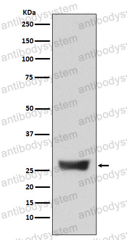 Anti-NDUFS3 Antibody (R1F39)