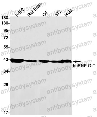 Anti-RBMXL2 Antibody (R1F43)
