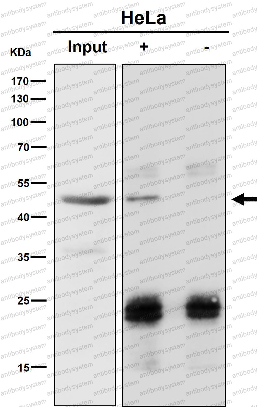 Anti-RBMXL2 Antibody (R1F42)