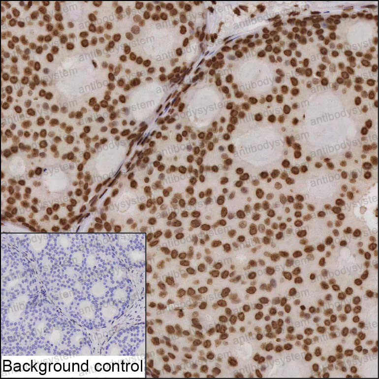 Anti-TAF5L Antibody (R2V78)