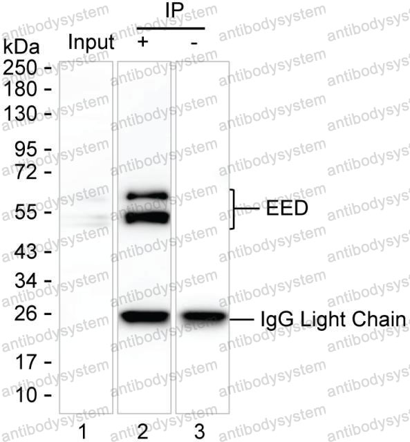 Anti-EED Antibody (R2V79)