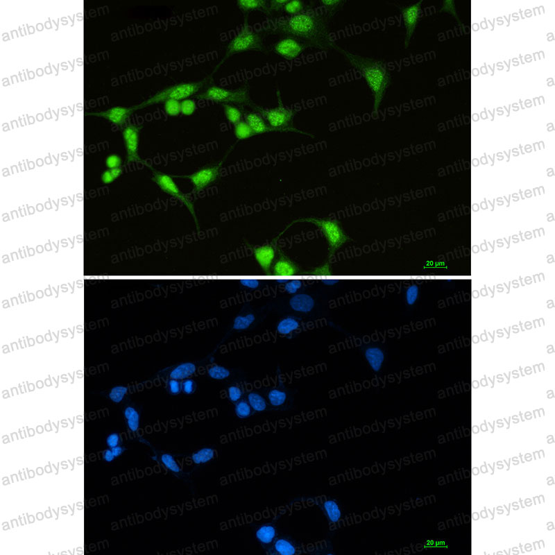 Anti-SF3B1 Antibody (R1F47)
