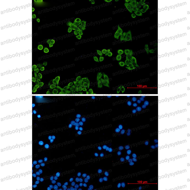Anti-CSDE1 Antibody (R1F50)