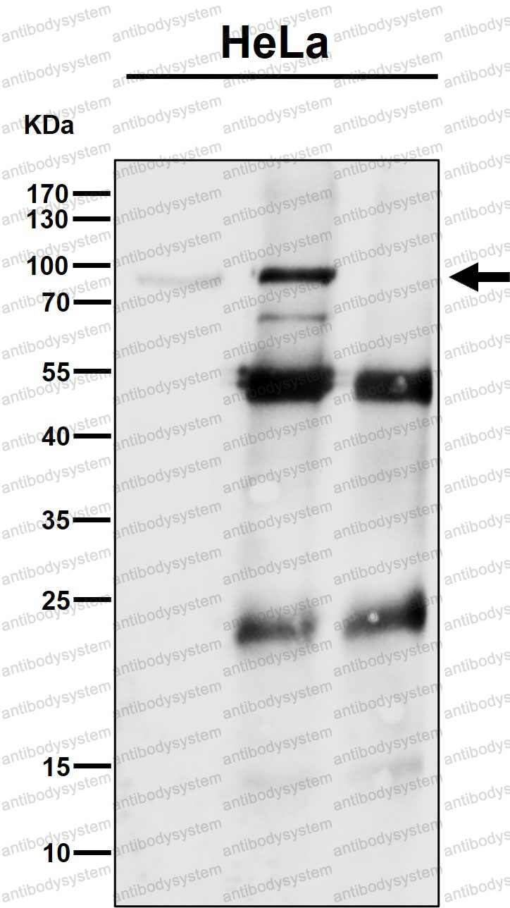 Anti-CSDE1 Antibody (R1F49)