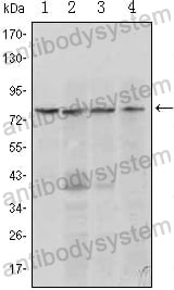 Anti-PRDM1 Antibody (R2V84)