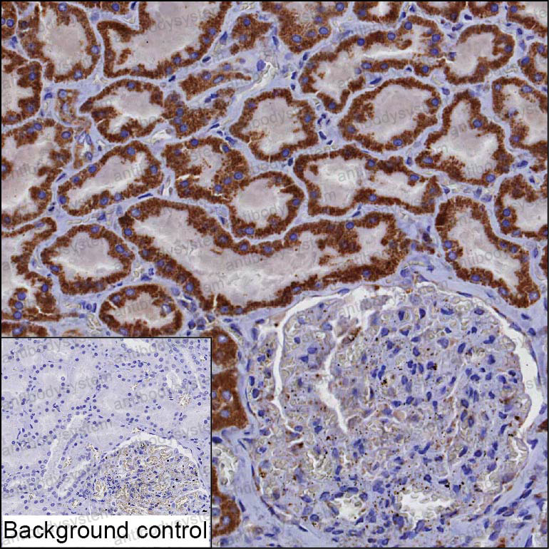 Anti-ATP6AP2/Prorenin receptor Antibody (R2V88)