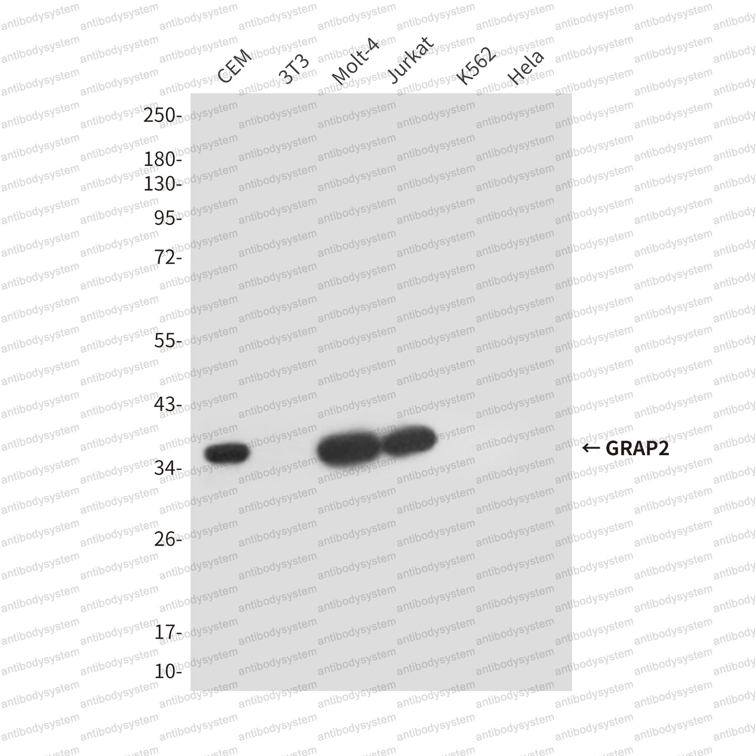 Anti-GRAP2 Antibody (R2V89)