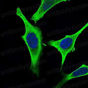 Anti-GABBR2 Antibody (R2V95)