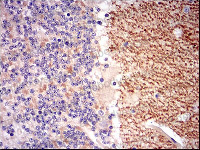 Anti-GABBR2 Antibody (R2V96)