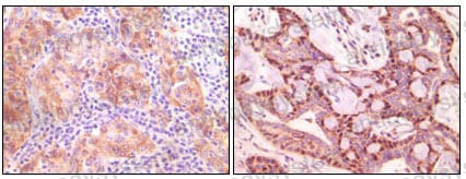 Anti-SNCG Antibody (R2W02)