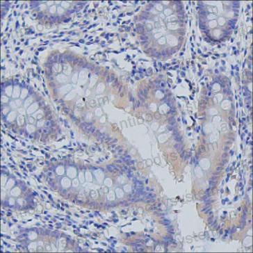 Anti-PDE5A Antibody (R2W03)