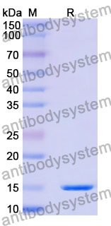 Anti-Human RECQL5 Nanobody (SAA1135)