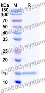 Anti-Human RECQL5 Nanobody (SAA1133)