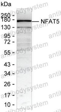Anti-NFAT5 Antibody (R2W07)