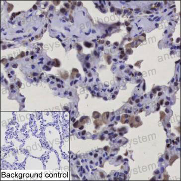 Anti-FAM13A Antibody (R2W11)