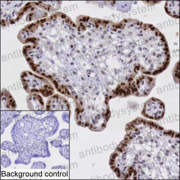 Anti-HEXIM1 Antibody (R2W12)