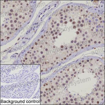 Anti-UBR5 Antibody (R2W14)