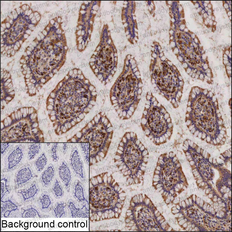 Anti-ELP1 Antibody (R2W16)