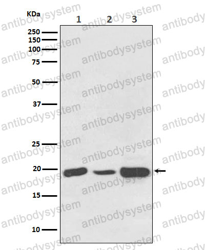 Western blot for Anti-NDUFB8 Antibody (R1G28) ?>