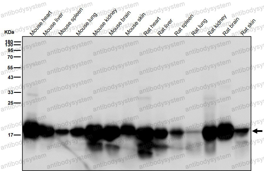 Western blot for Anti-NDUFB8 Antibody (R1G28) ?>