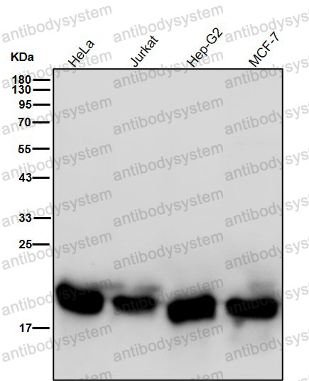 Western blot for Anti-NDUFB8 Antibody (R1G28) ?>