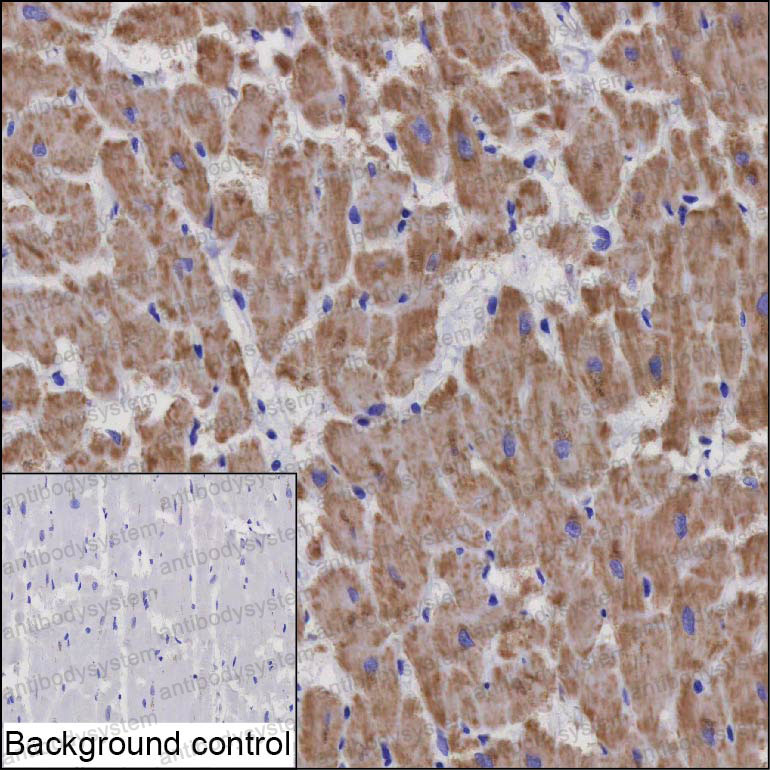 Anti-NDUFB8 Antibody (R2W18)