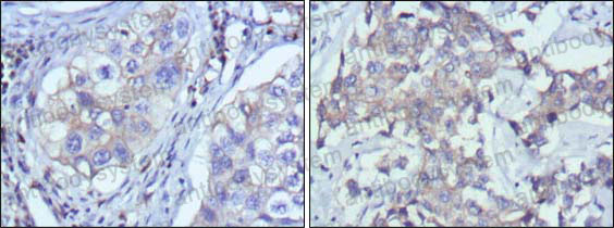 Anti-RTN3 Antibody (R2W19)