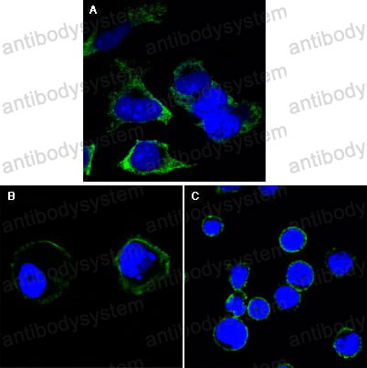 Anti-RTN3 Antibody (R2W20)