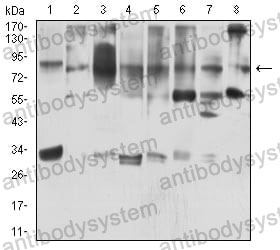 Anti-KAT7 Antibody (R2W22)