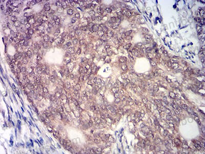 Anti-KAT7 Antibody (R2W21)