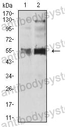 Anti-HTR3B Antibody (R2W24)