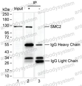 Anti-SMC2 (acetyl K114) Antibody (R2W25)