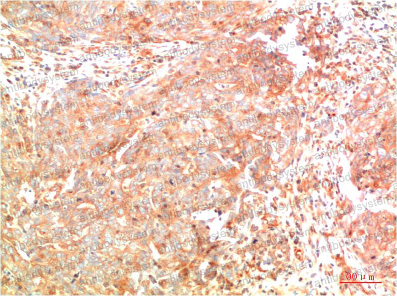 Anti-ATG7 Antibody (R2W27)