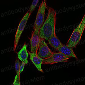 Anti-PAPLN Antibody (R2W29)