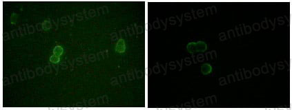 Anti-APOM Antibody (R2W31)