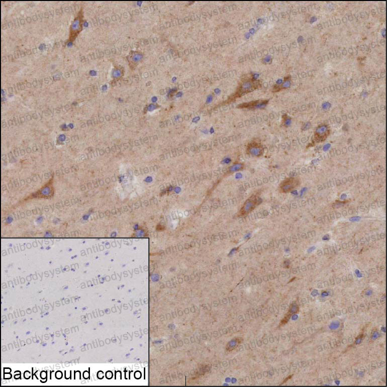 Anti-NPTXR Antibody (R2W33)