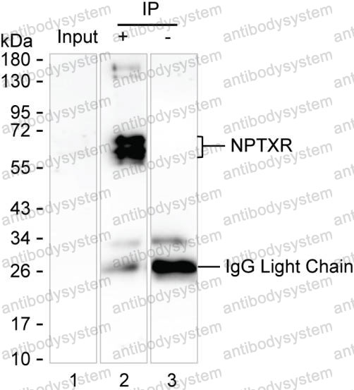Anti-NPTXR Antibody (R2W34)