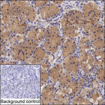 Anti-NADK Antibody (R2W35)