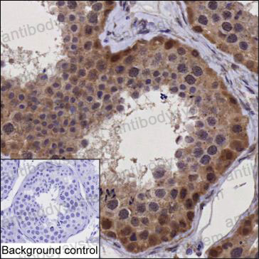 Anti-STAMBP Antibody (R2W37)