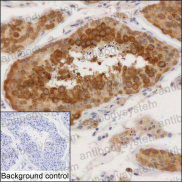 Anti-CEP43 Antibody (R2W38)