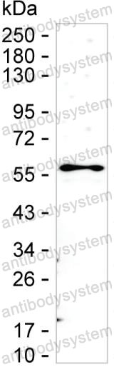 Anti-STAU1 Antibody (R2W41)