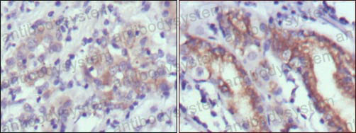 Anti-CER1 Antibody (R2W42)