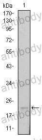 Anti-SNAI1 Antibody (R2W46)