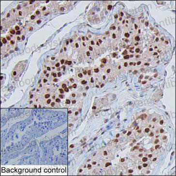 Anti-PTTG1 Antibody (R2W55)