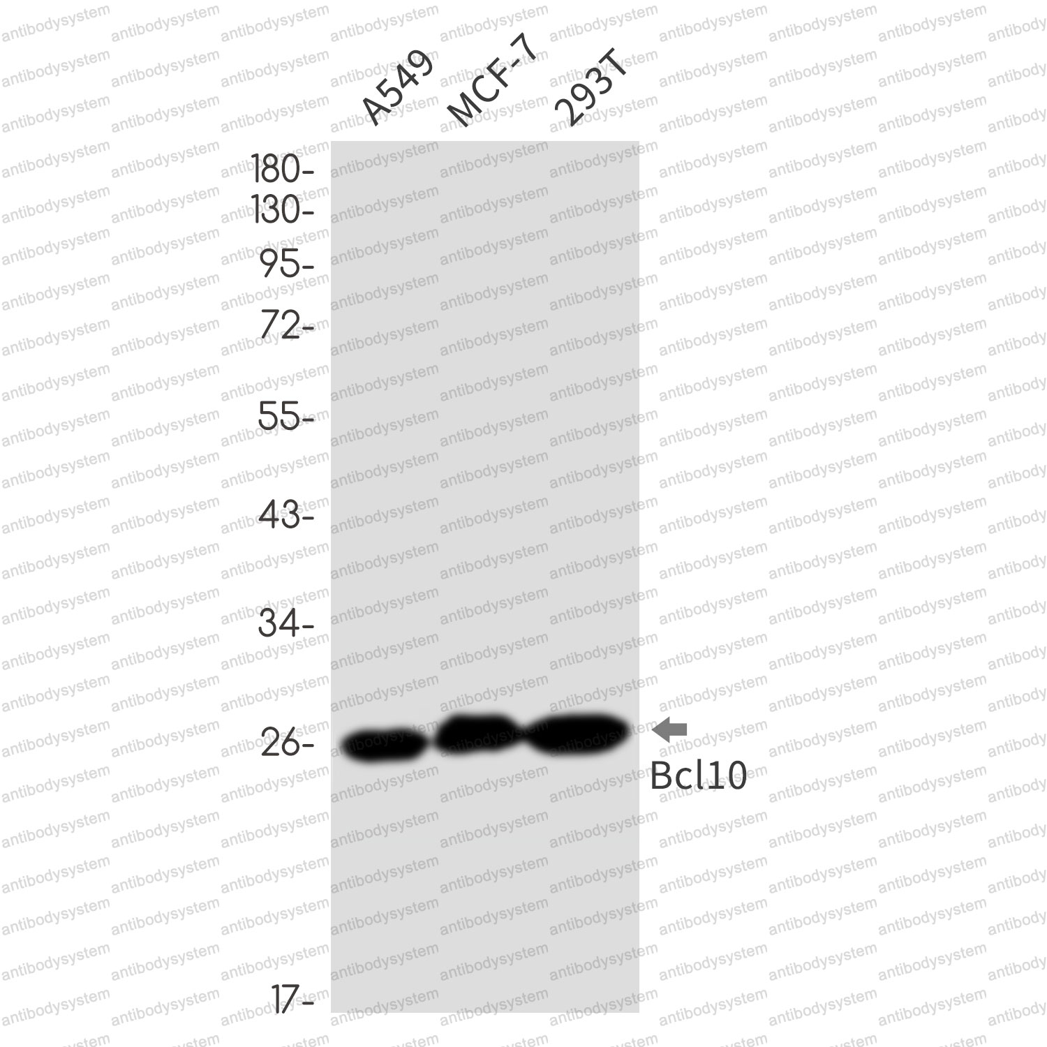 Anti-BCL10 Antibody (R1G89)