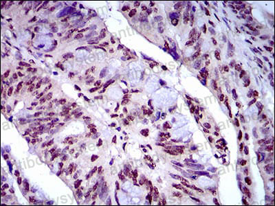 Anti-NAPSA Antibody (R2W58)