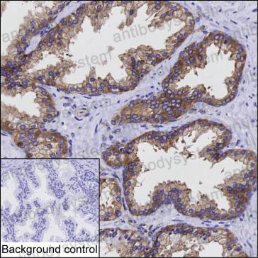 Anti-PAK4 Antibody (R2W60)