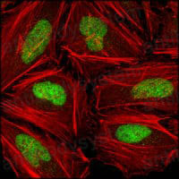 Anti-CHEK2 Antibody (R2W63)